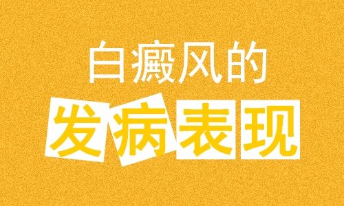 榜单刷新:深圳白癜风医院5月排名总榜公开_如何护理手部长白癜风?